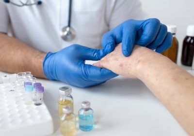 Obtenir un rendez-vous chez un dermatologue ? On a enquêté !